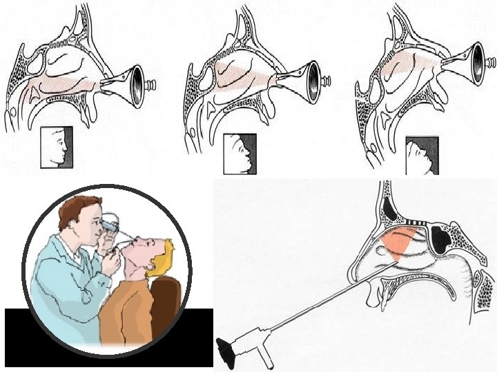 nez sinus 1 19 