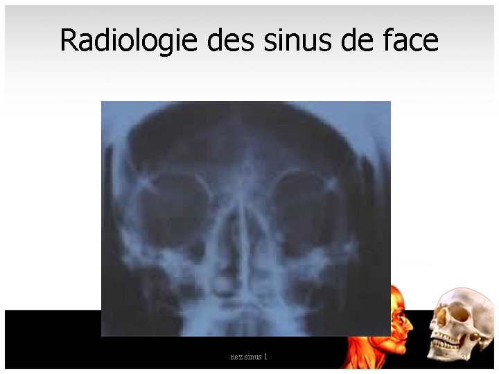 Radiologie des sinus de face nez sinus 1 31 