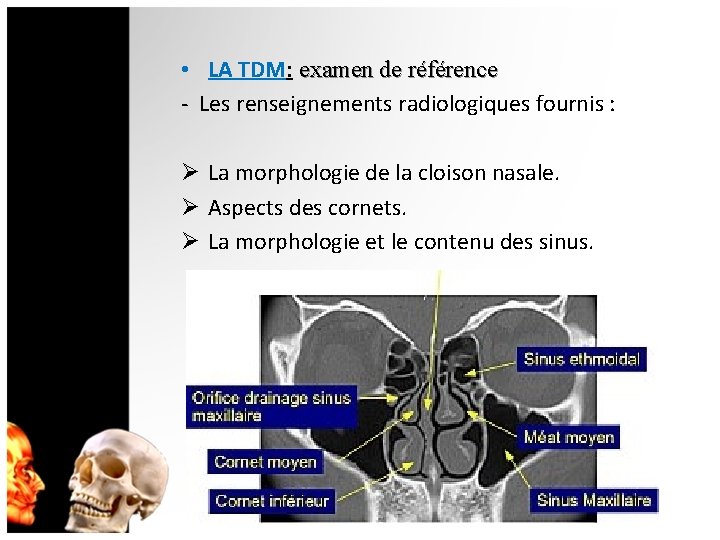  • LA TDM: examen de référence - Les renseignements radiologiques fournis : Ø