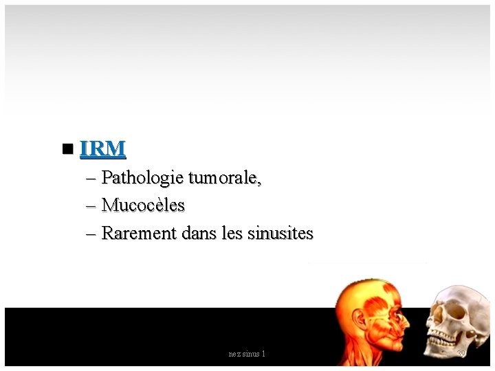 n IRM – Pathologie tumorale, – Mucocèles – Rarement dans les sinusites nez sinus