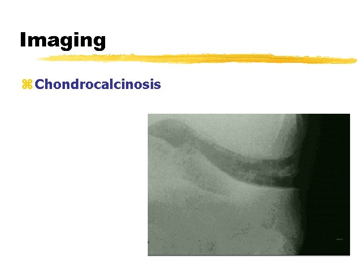 Imaging z Chondrocalcinosis 