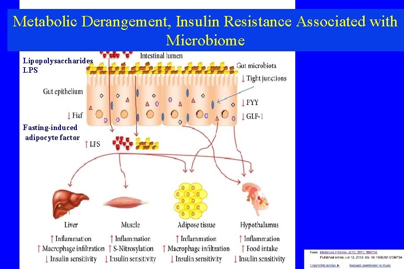 Metabolic Derangement, Insulin Resistance Associated with Microbiome Lipopolysaccharides LPS Fasting-induced adipocyte factor 