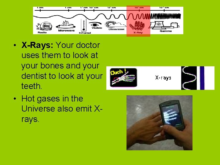  • X-Rays: Your doctor uses them to look at your bones and your