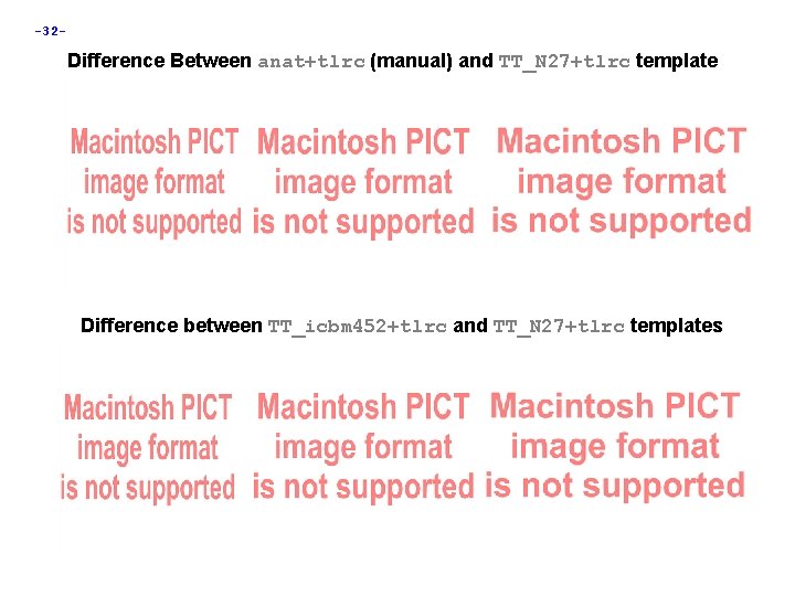 -32 - Difference Between anat+tlrc (manual) and TT_N 27+tlrc template Difference between TT_icbm 452+tlrc