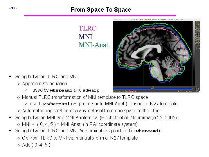 -35 - From Space To Space TLRC MNI-Anat. • Going between TLRC and MNI: