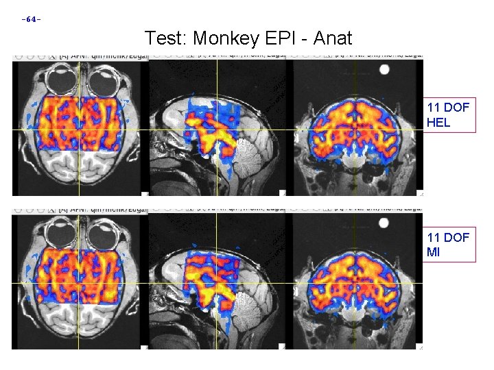 -64 - Test: Monkey EPI - Anat 11 DOF HEL 11 DOF MI 