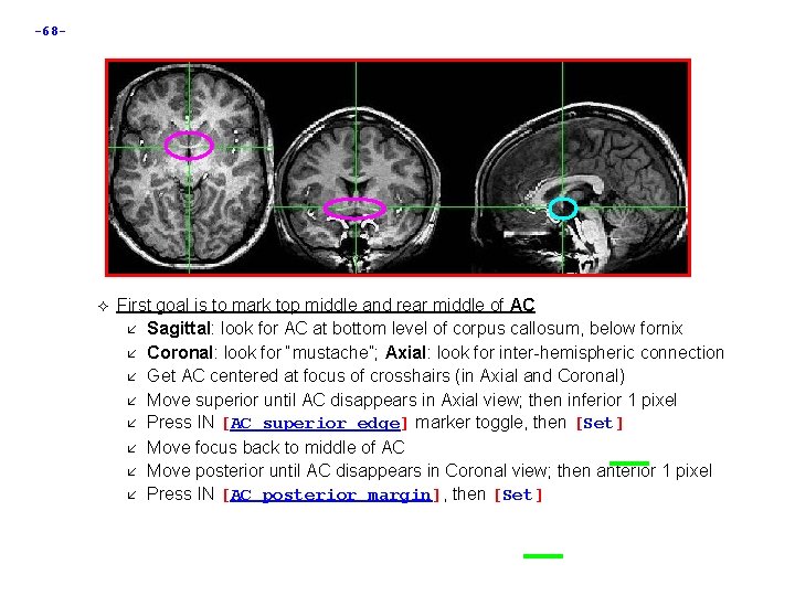 -68 - First goal is to mark top middle and rear middle of AC -68 - First goal is to mark top middle and rear middle of AC