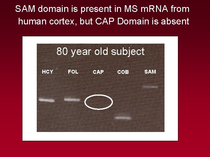 SAM domain is present in MS m. RNA from human cortex, but CAP Domain