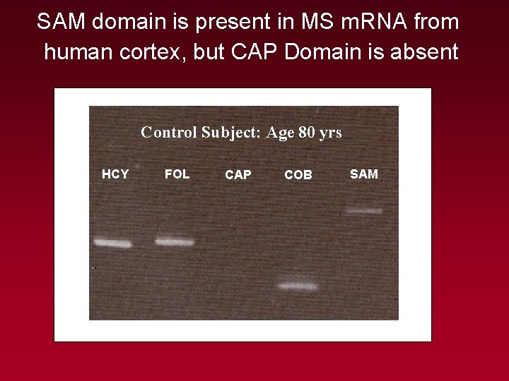 SAM domain is present in MS m. RNA from human cortex, but CAP Domain