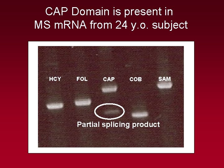 CAP Domain is present in MS m. RNA from 24 y. o. subject HCY CAP Domain is present in MS m. RNA from 24 y. o. subject HCY