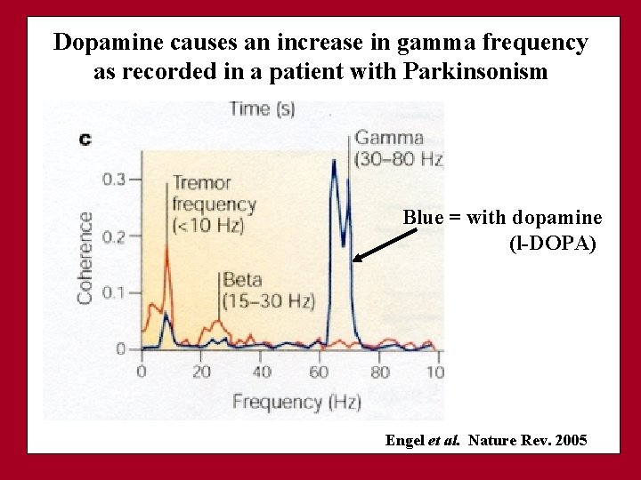 Dopamine causes an increase in gamma frequency as recorded in a patient with Parkinsonism