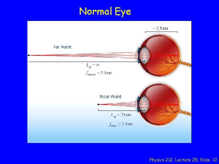 Normal Eye Physics 212 Lecture 28, Slide 12 