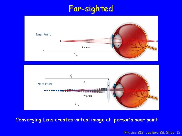 Far-sighted Converging Lens creates virtual image at person’s near point Physics 212 Lecture 28,