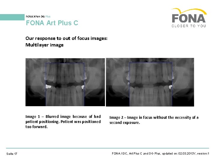 FONA XPan DG Plus FONA Art Plus C Our response to out of focus