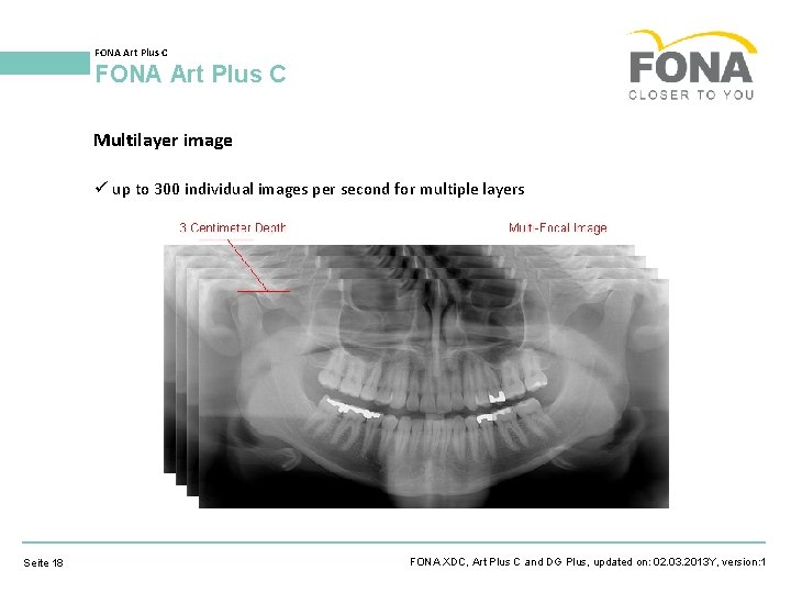 FONA Art Plus C Multilayer image up to 300 individual images per second for