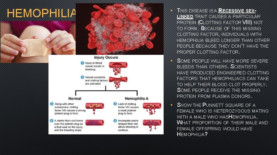 HEMOPHILIA • THIS DISEASE IS A RECESSIVE SEXLINKED TRAIT CAUSES A PARTICULAR PROTEIN (CLOTTING