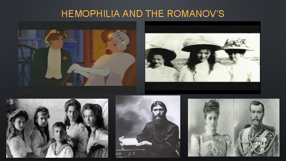 HEMOPHILIA AND THE ROMANOV’S 