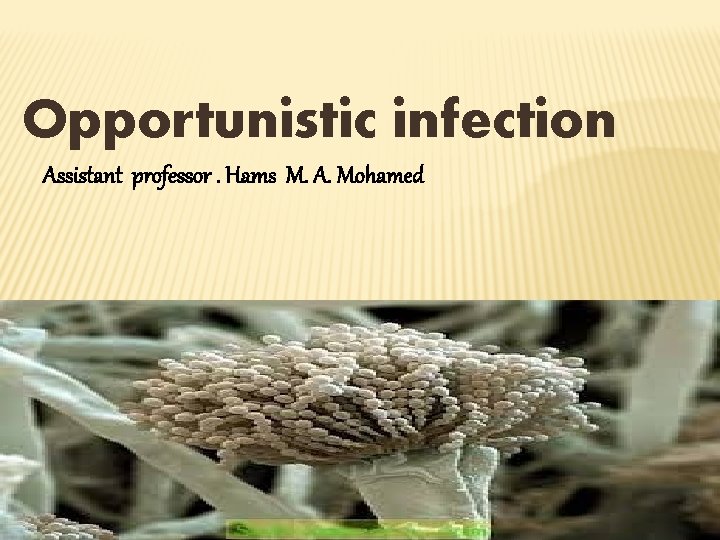 Opportunistic infection Assistant professor. Hams M. A. Mohamed 