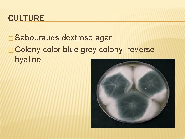 CULTURE � Sabourauds dextrose agar � Colony color blue grey colony, reverse hyaline 