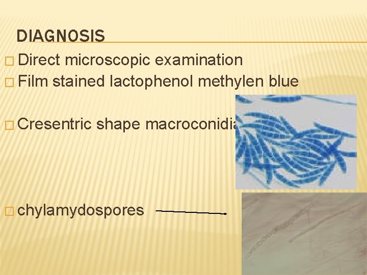 DIAGNOSIS � Direct microscopic examination � Film stained lactophenol methylen blue � Cresentric shape