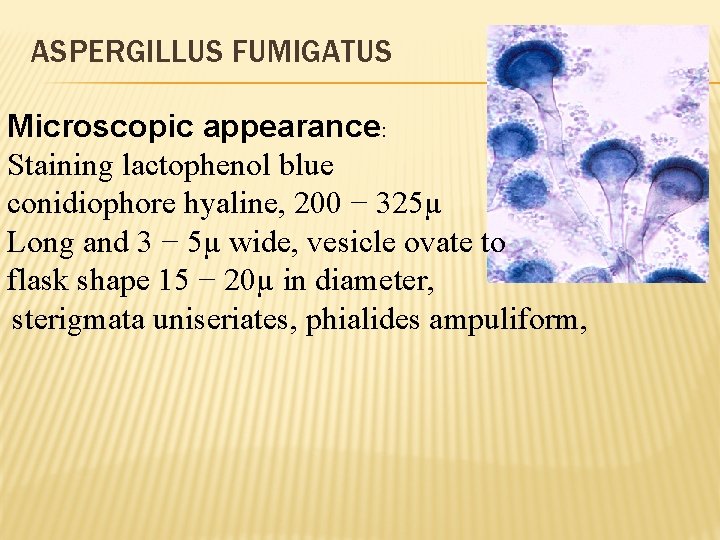 ASPERGILLUS FUMIGATUS Microscopic appearance: Staining lactophenol blue conidiophore hyaline, 200 − 325µ Long and