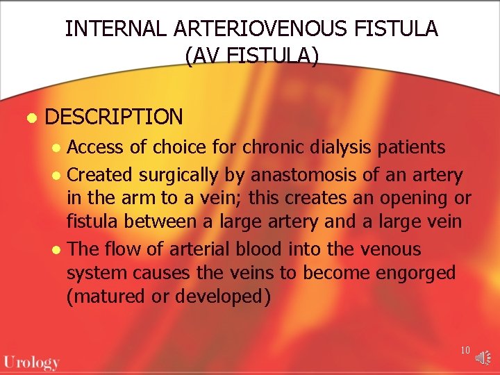 INTERNAL ARTERIOVENOUS FISTULA (AV FISTULA) l DESCRIPTION Access of choice for chronic dialysis patients