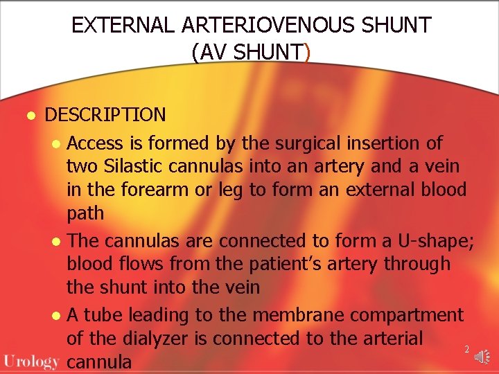 EXTERNAL ARTERIOVENOUS SHUNT (AV SHUNT) l DESCRIPTION l Access is formed by the surgical