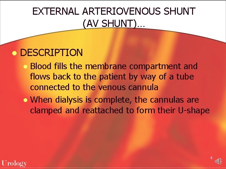 EXTERNAL ARTERIOVENOUS SHUNT (AV SHUNT)… l DESCRIPTION Blood fills the membrane compartment and flows