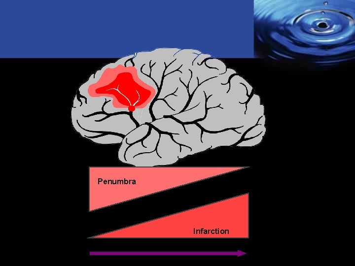 Penumbra Infarction 