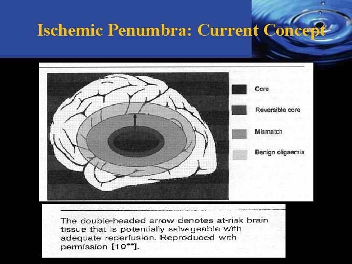 Ischemic Penumbra: Current Concept 