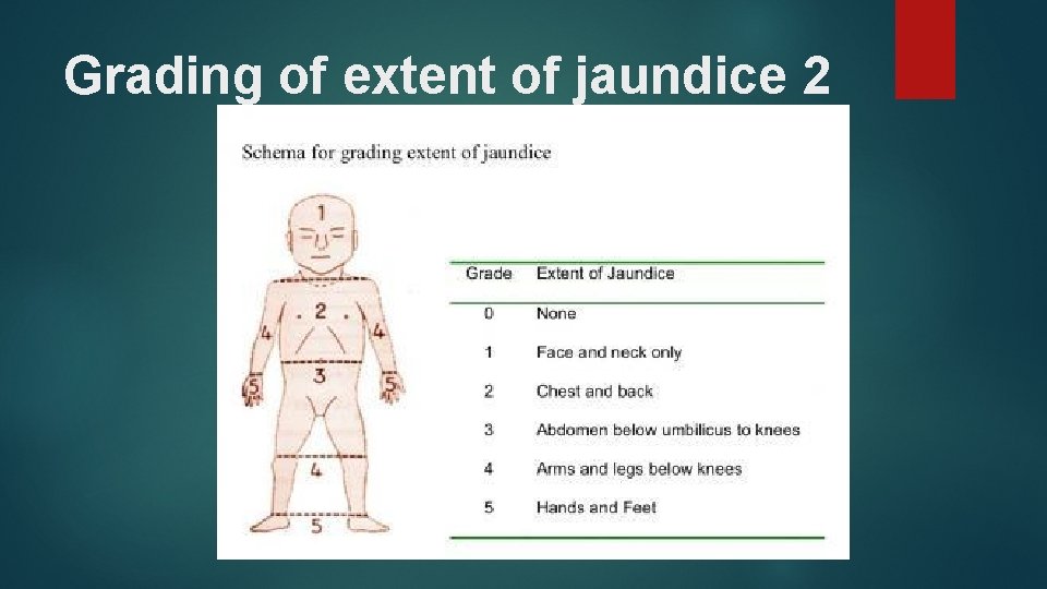 Grading of extent of jaundice 2 