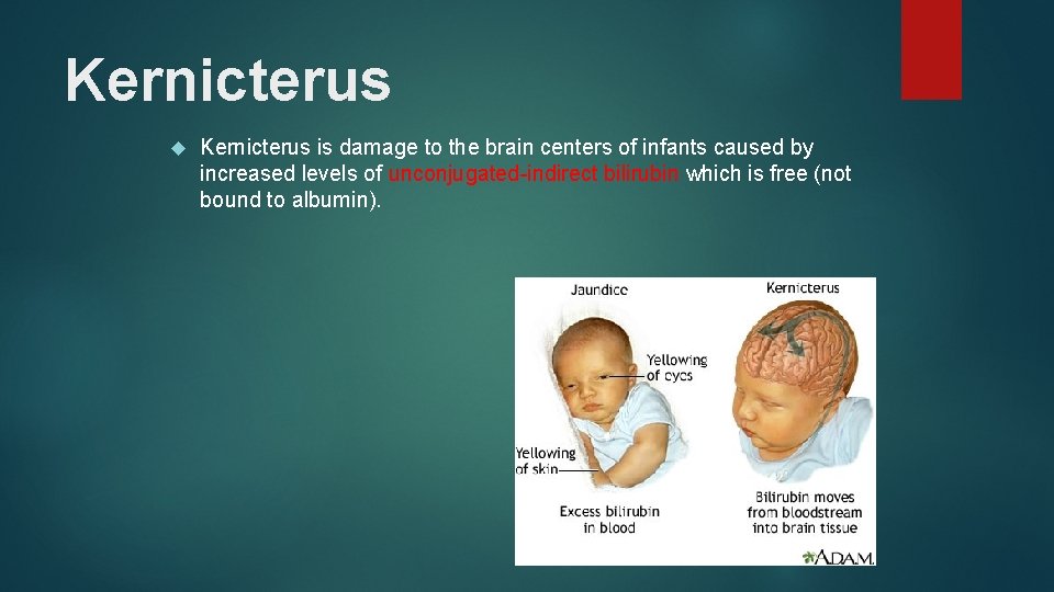 Kernicterus is damage to the brain centers of infants caused by increased levels of