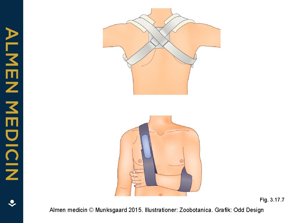 Fig. 3. 17. 7 Almen medicin © Munksgaard 2015. Illustrationer: Zoobotanica. Grafik: Odd Design