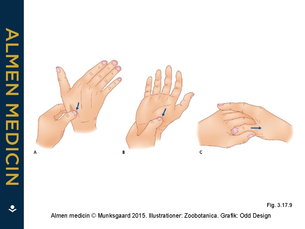 Fig. 3. 17. 9 Almen medicin © Munksgaard 2015. Illustrationer: Zoobotanica. Grafik: Odd Design