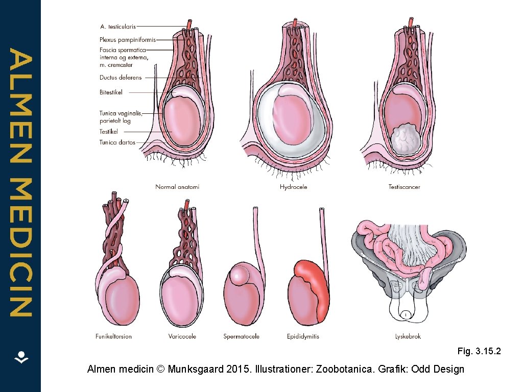 Fig. 3. 15. 2 Almen medicin © Munksgaard 2015. Illustrationer: Zoobotanica. Grafik: Odd Design