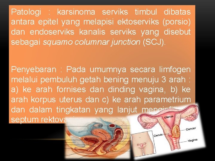 Patologi : karsinoma serviks timbul dibatas antara epitel yang melapisi ektoserviks (porsio) dan endoserviks