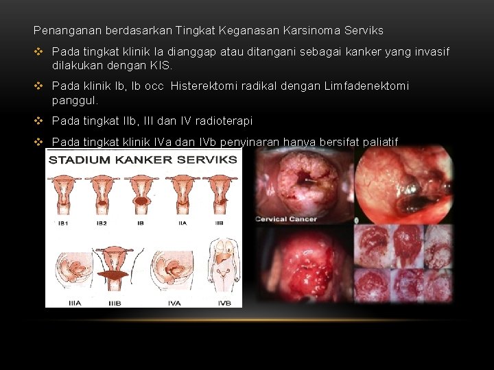 Penanganan berdasarkan Tingkat Keganasan Karsinoma Serviks v Pada tingkat klinik Ia dianggap atau ditangani