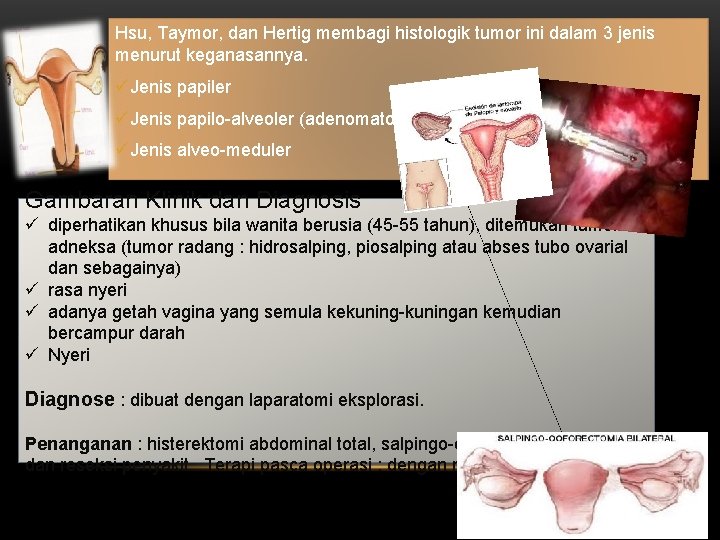 Hsu, Taymor, dan Hertig membagi histologik tumor ini dalam 3 jenis menurut keganasannya. üJenis