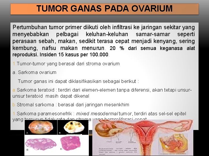 TUMOR GANAS PADA OVARIUM Pertumbuhan tumor primer diikuti oleh infiltrasi ke jaringan sekitar yang