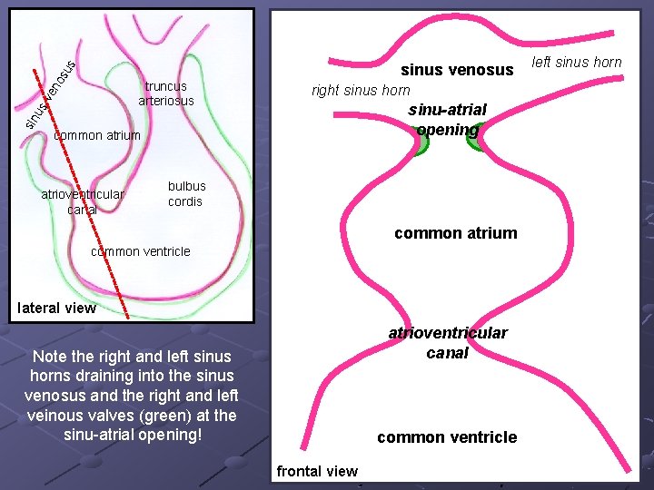 os us sinus venosus sin u sv en truncus arteriosus right sinus horn sinu-atrial os us sinus venosus sin u sv en truncus arteriosus right sinus horn sinu-atrial