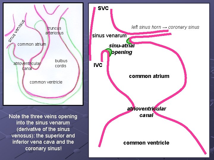 os us SVC sin u sv en truncus arteriosus left sinus horn → coronary os us SVC sin u sv en truncus arteriosus left sinus horn → coronary