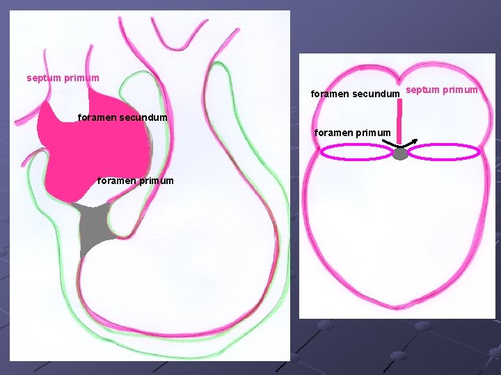 septum primum foramen secundum foramen primum septum primum foramen secundum foramen primum