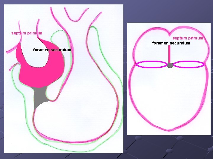 septum primum foramen secundum septum primum foramen secundum