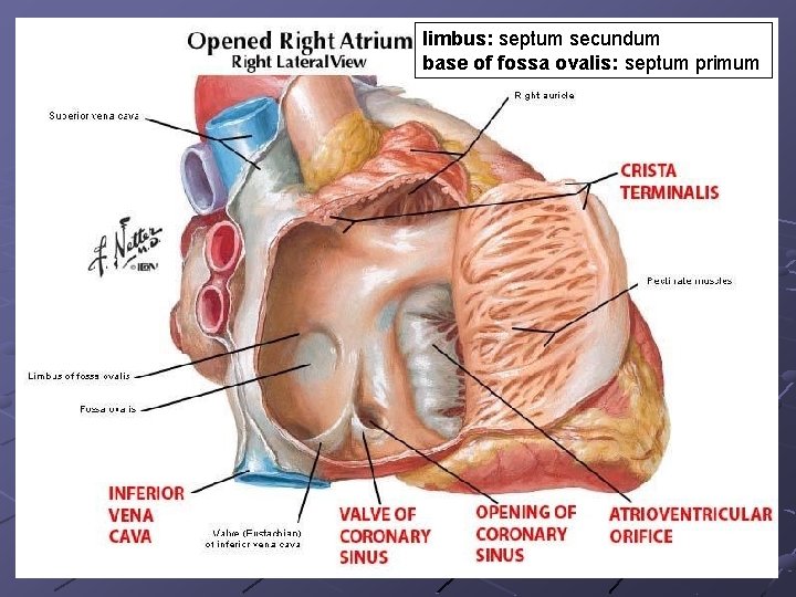 limbus: septum secundum base of fossa ovalis: septum primum limbus: septum secundum base of fossa ovalis: septum primum