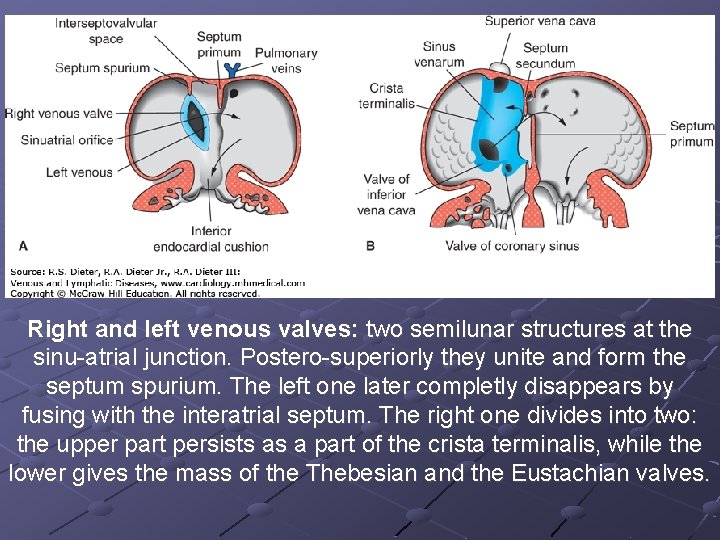 Right and left venous valves: two semilunar structures at the sinu-atrial junction. Postero-superiorly they Right and left venous valves: two semilunar structures at the sinu-atrial junction. Postero-superiorly they