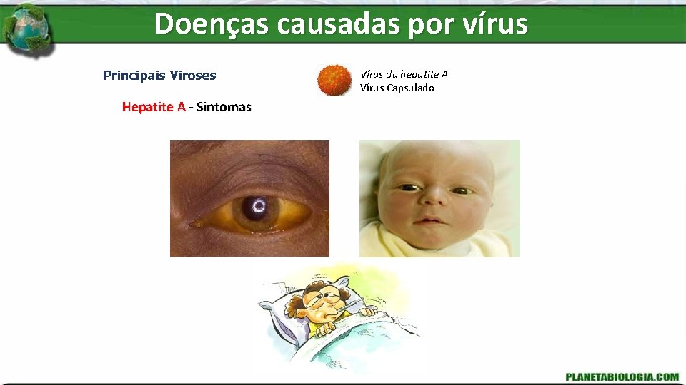 Doenças causadas por vírus Principais Viroses Hepatite A - Sintomas Vírus da hepatite A