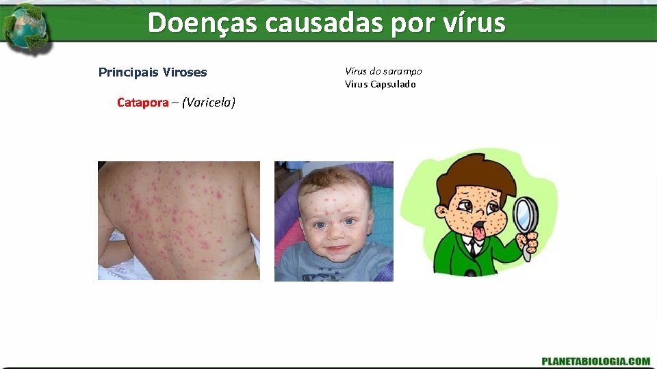 Doenças causadas por vírus Principais Viroses Catapora – (Varicela) Vírus do sarampo Vírus Capsulado