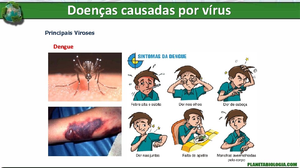 Doenças causadas por vírus Principais Viroses Dengue 