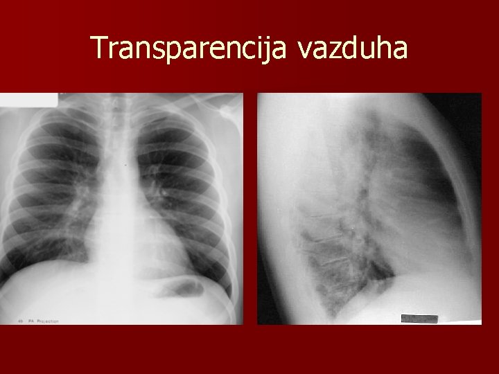 Transparencija vazduha 