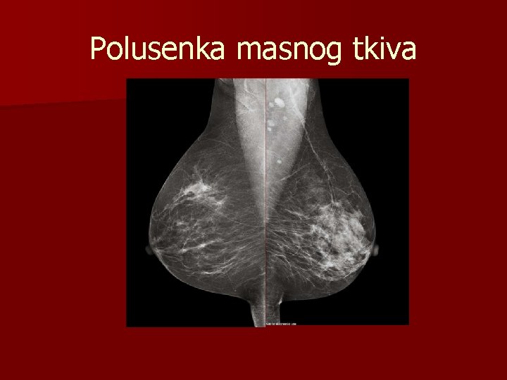 Polusenka masnog tkiva 